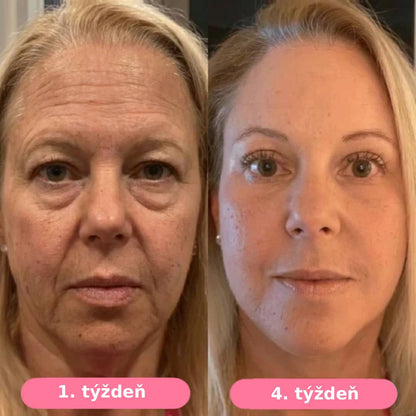 Serum Collagen