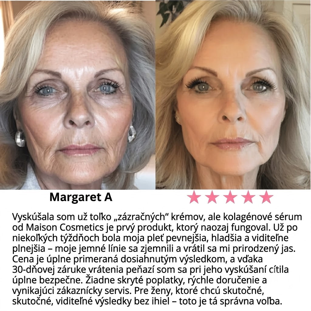 Serum Collagen