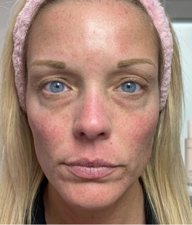 Marína, 38